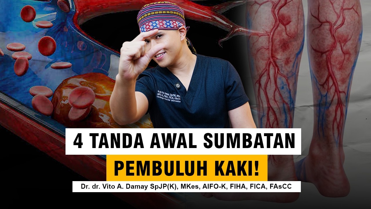 Dr Vito | 4 Tanda Awal Sumbatan Pembuluh Darah Kaki yang Sering Diabaikan! Waspada Sebelum Terlambat