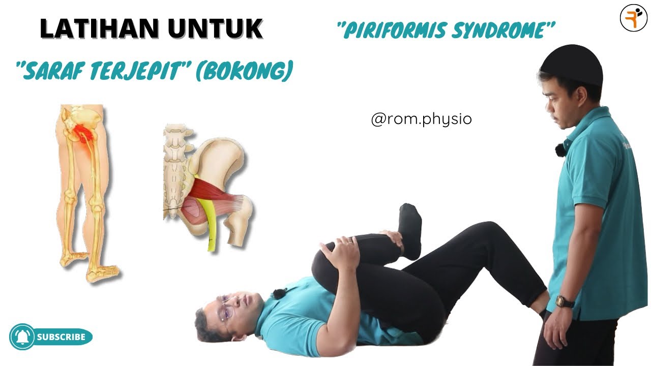 Cara Mengatasi “SARAF TERJEPIT PADA BOKONG” (Piriformis Syndrome) #romfis