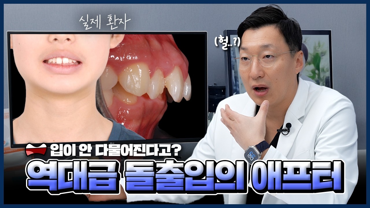 원장님도 보고 입을 다물 수 없었던 최상급 케이스...!😱