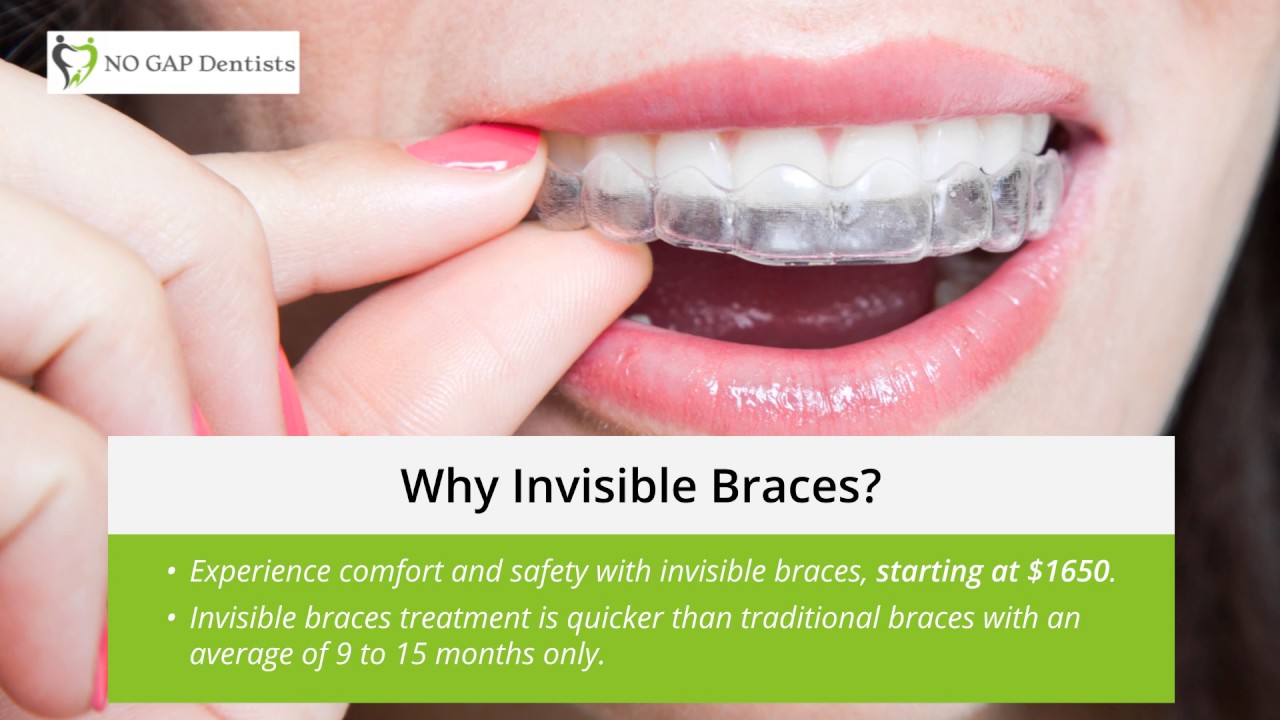 Your Best Place for Invisible Braces in Melbourne