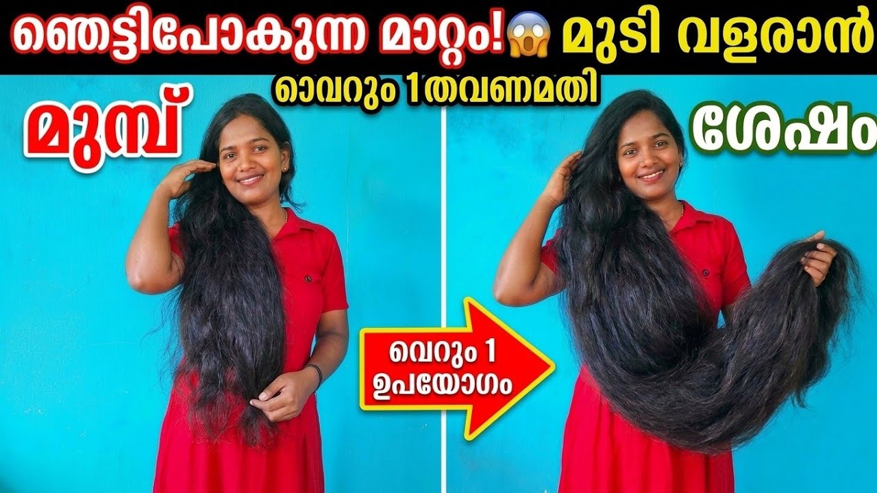 കൊഴിഞ്ഞു തീർന്ന എന്റെ മുടി ഇതുപോലെ വളരാൻ ഞാൻ ഏറ്റവും കൂടുതൽ use ചെയ്തത് ഇതാണ്🔥100%Effective#haircare