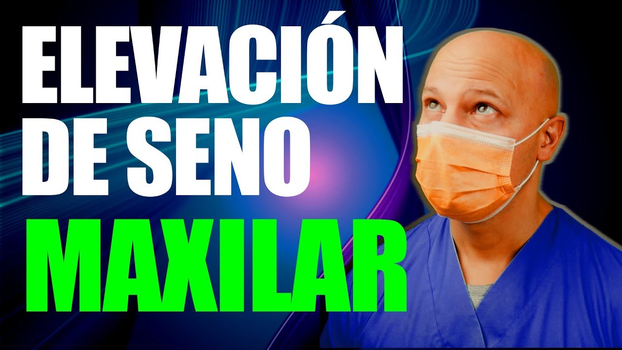 INJERTO DE HUESO EN EL SENO MAXILAR 🤔 (elevación paso a paso)