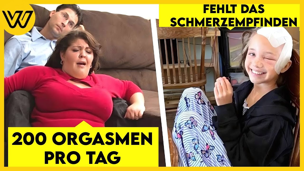 10 unglaubliche Menschen mit einmaligen Krankheiten
