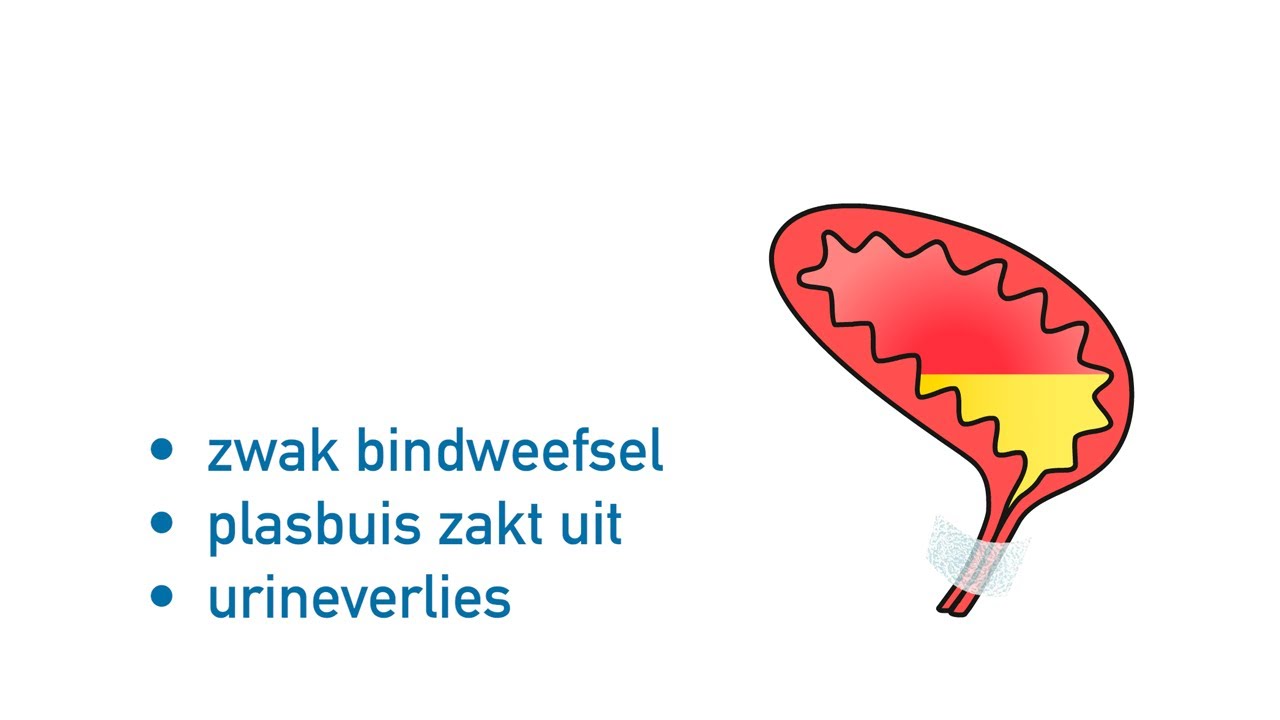 Wat is stressincontinentie