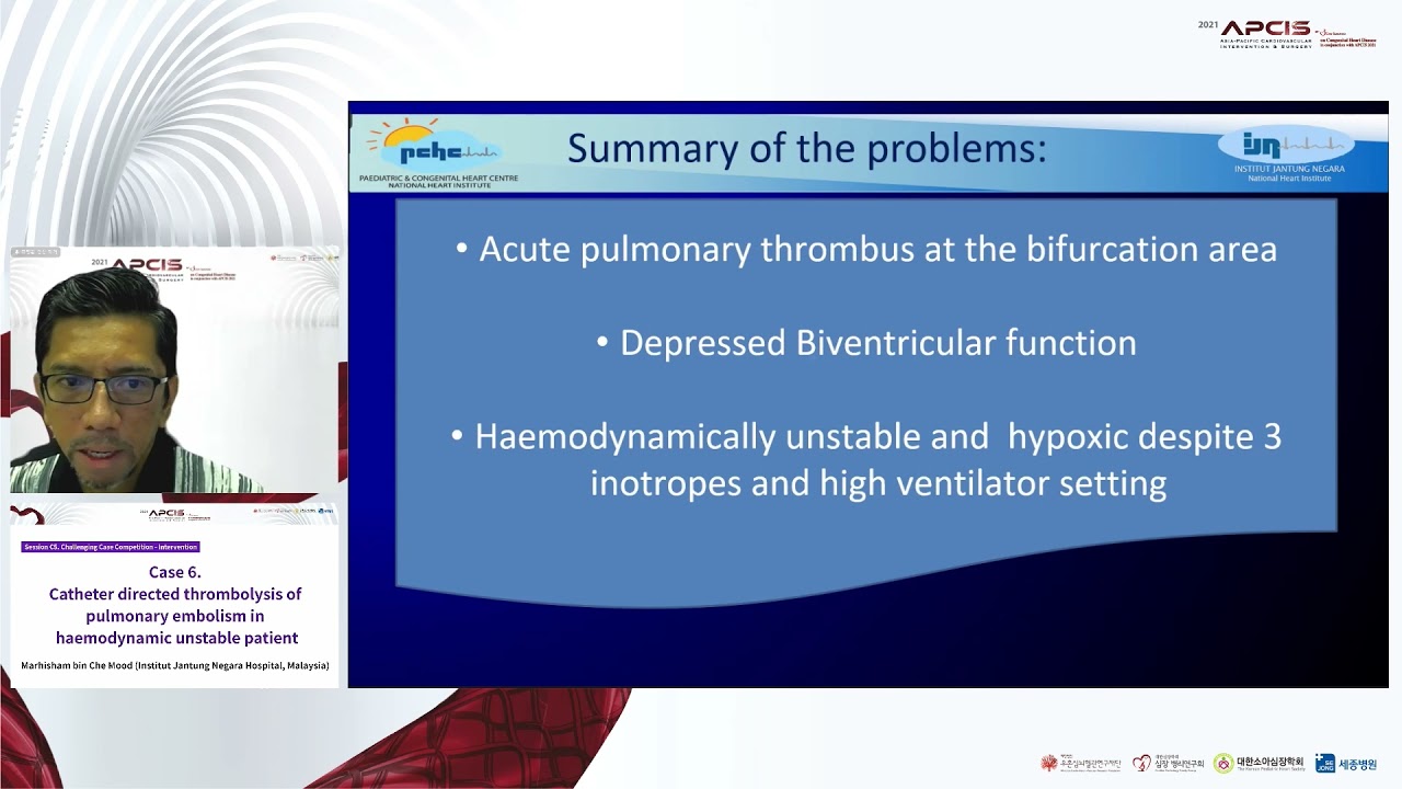 Catheter directed thrombolysis of pulmonary embolism in  haemodynamic unstable patient