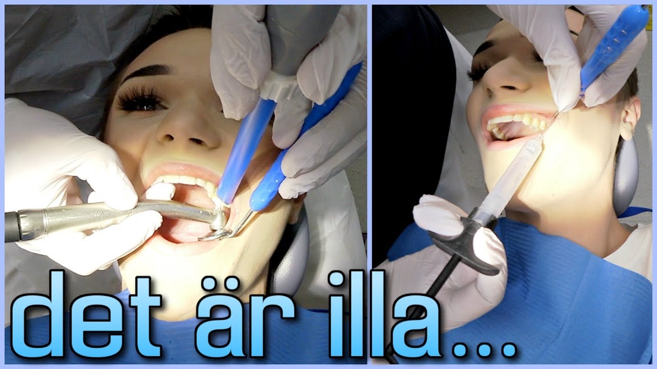 HOS TANDLÄKAREN (det är illa...) | Vlogg