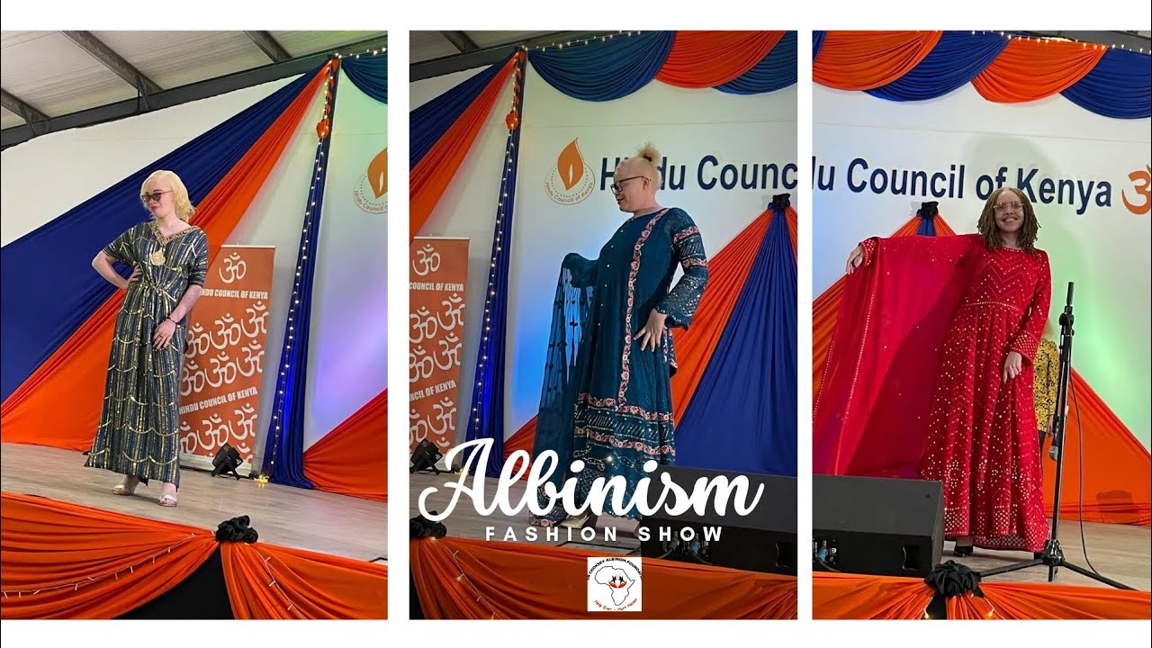 ALBINISM FASHION SHOW #albinism #hopeforall #helpeverhurtnever #drchoksey