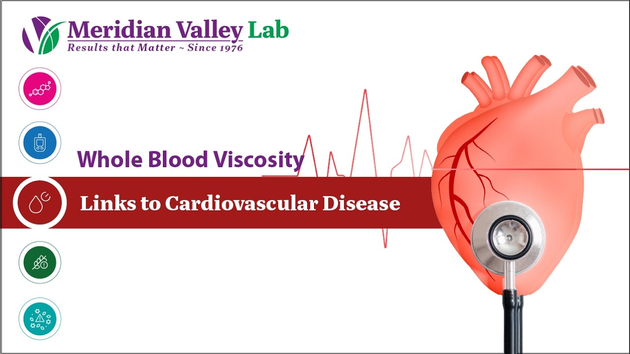 Whole Blood Viscosity: Links to Cardiovascular Disease