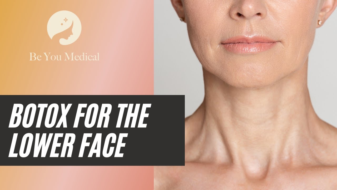 Botox For The Lower Face
