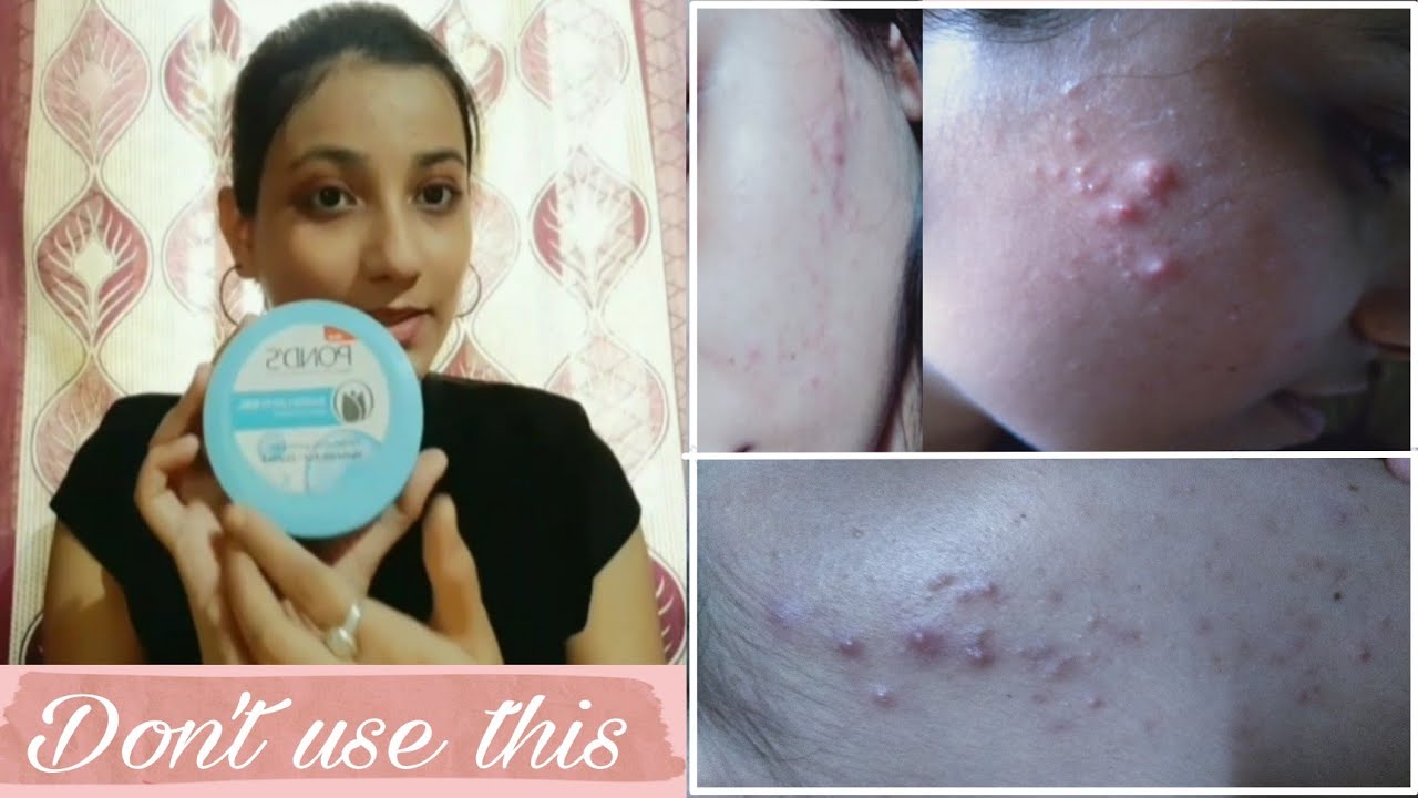 Pond's Super Light Gel || Don't Use This Product ❌| Hindi |
