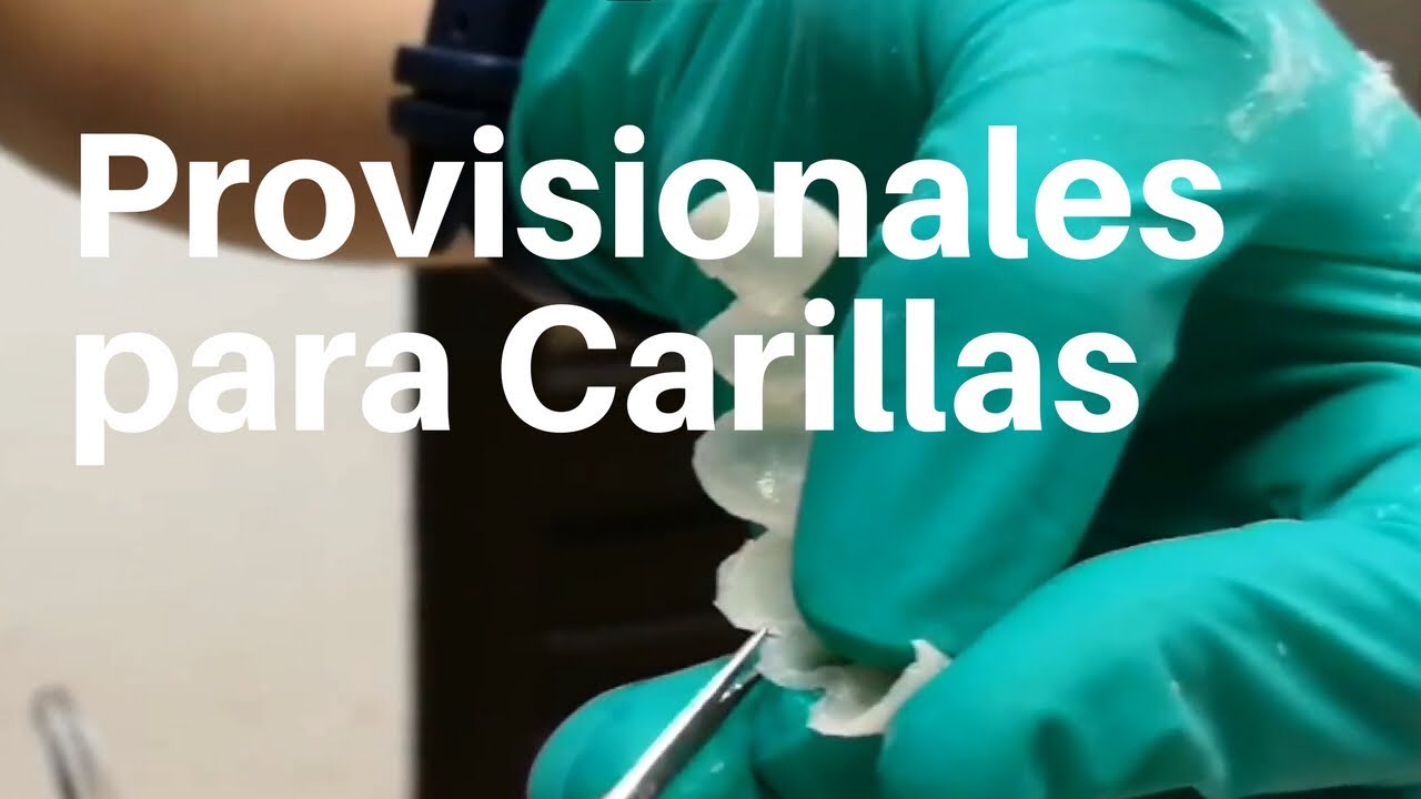🤔 Cómo❓hacer PROVISIONALES para CARILLAS👅 usando Llave de Silicona #dentaltip #CarillasDentales