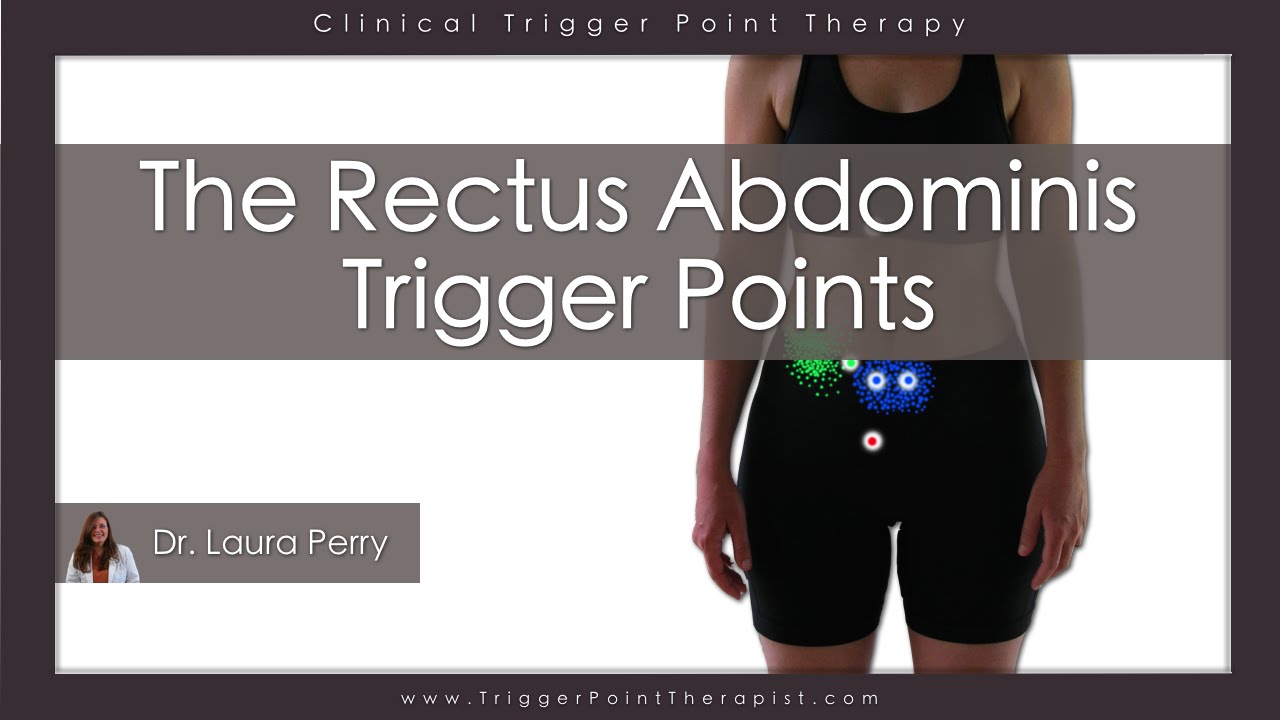 The Rectus Abdominis Trigger Points