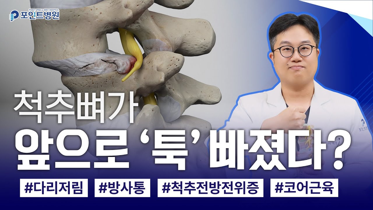 꽤 흔한 다리저림의 원인
