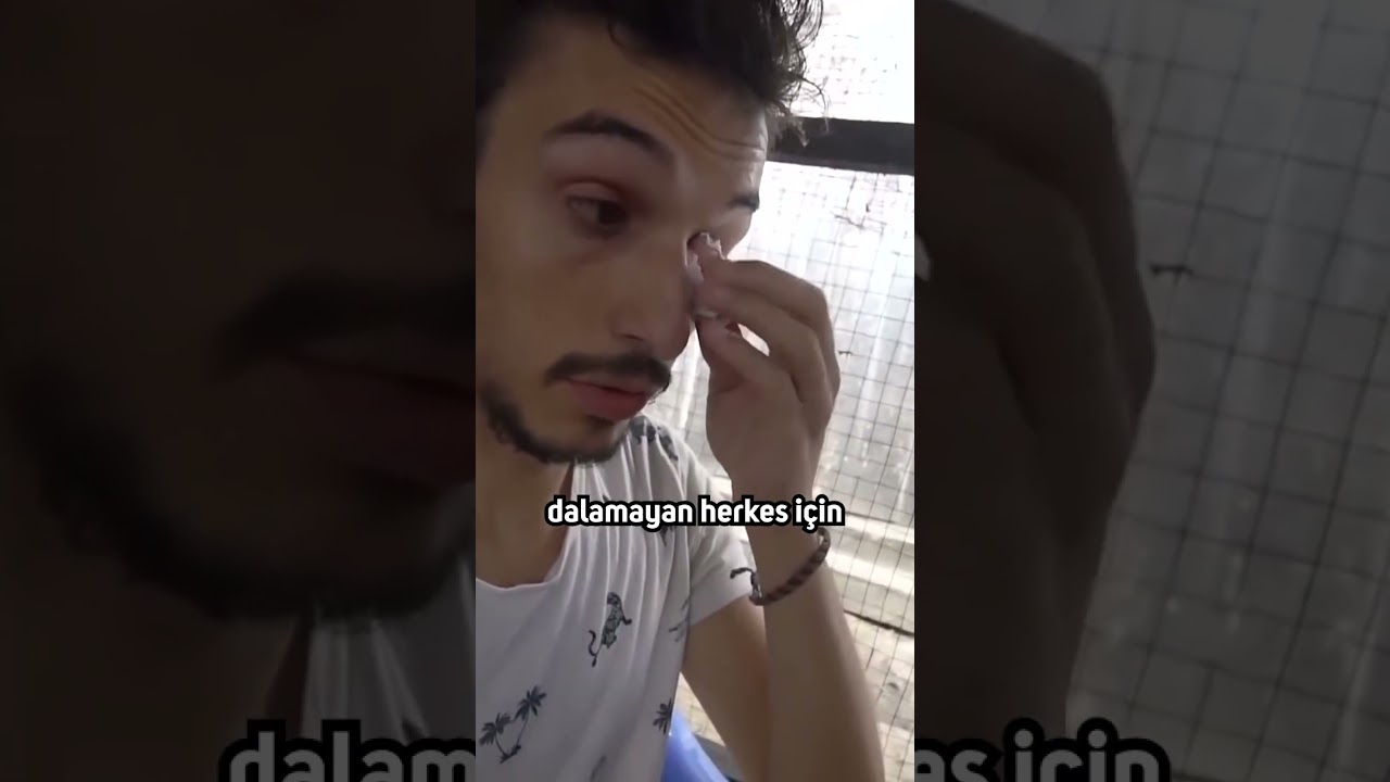 Peru&rsquo;da Sin&uuml;zit Tedavisini Nasıl Yapıyorlar #shorts
