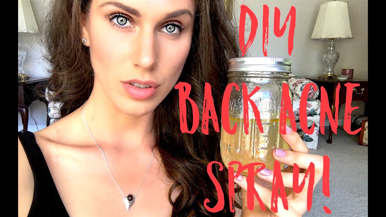 🌿 DIY Back Acne Spray (5 Ingredients)! | Cassandra Bankson