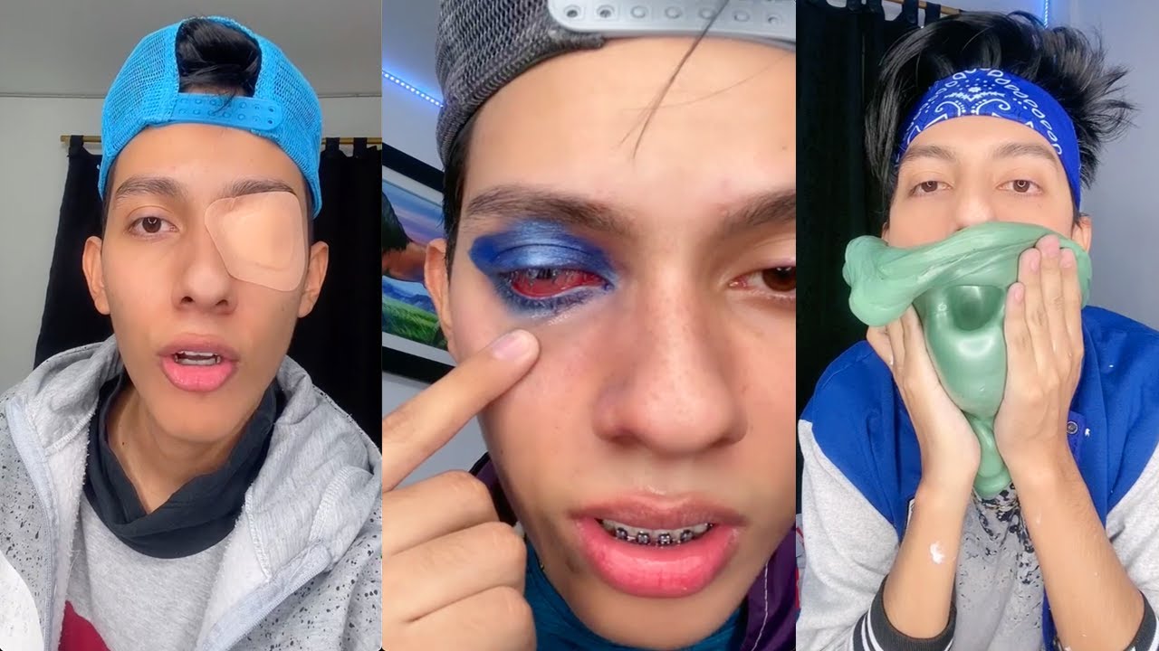 DAVID SE QUEDA CIEGO DE UN OJO | NUEVOS TIKTOK DE DAVID GETIAL Y SUS AMIGOS | HUMOR COLOMBIANO 😂