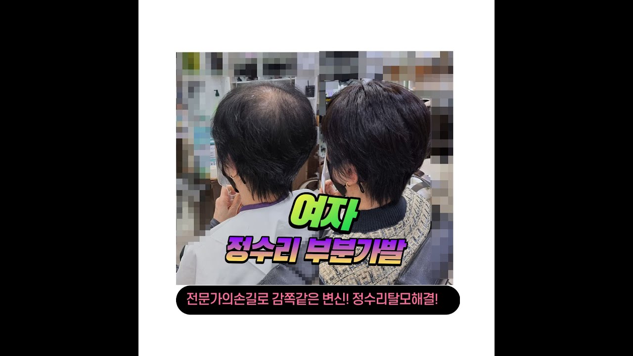 [부산]여자정수리부분가발/내모발같은 자연스러운가발/김호증모가발동래점
