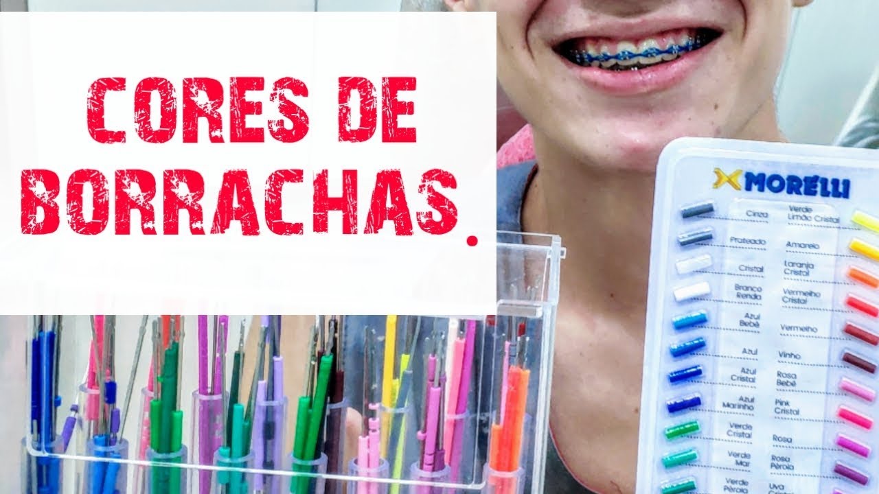 QUAIS AS CORES DAS BORRACHA DE APARELHOS VOCÊ MAIS GOSTA?