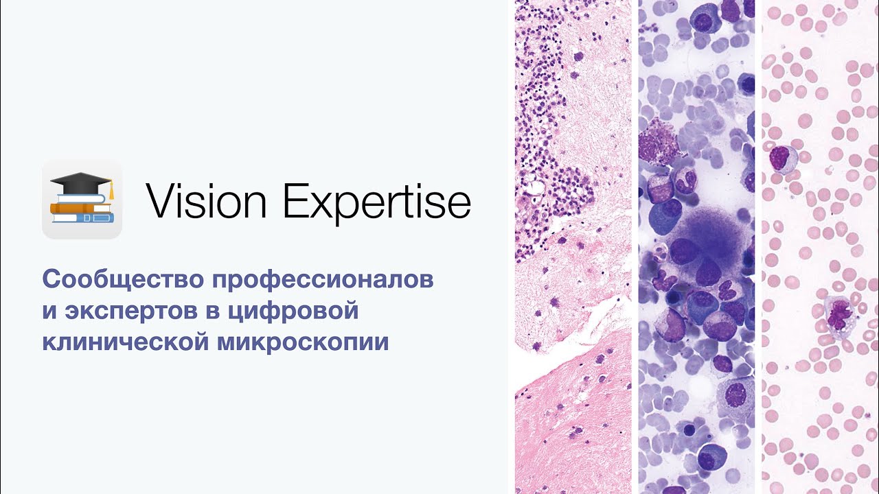 Цифровой обучающий сервис | Vision Expertise