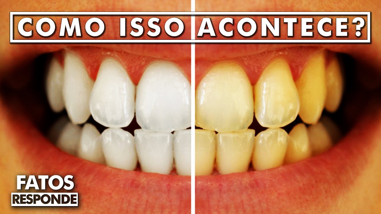 Por que os dentes ficam Amarelos? - FATOS RESPONDE