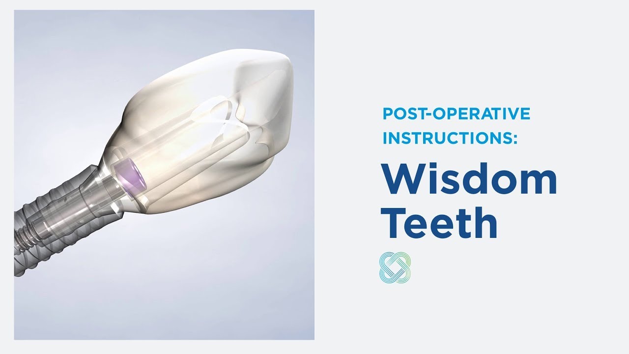 Post-Op Instructions: Wisdom Teeth Removal at Stephenville Oral Surgery & Dental Implants