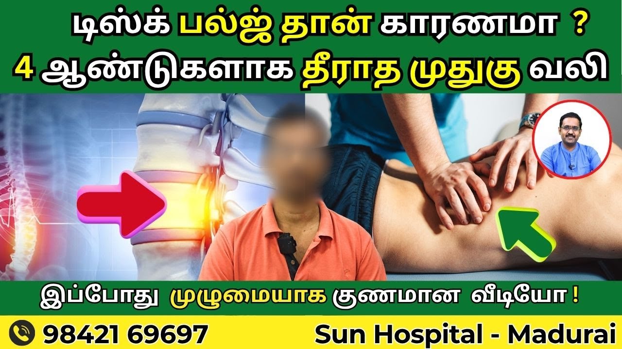டிஸ்க் பல்ஜ் தான் காரணமா ? 4ஆண்டுகளாக தீராத முதுகு வலி இப்போது முழுமையாக குணமான வீடியோ!|Sun Physio |