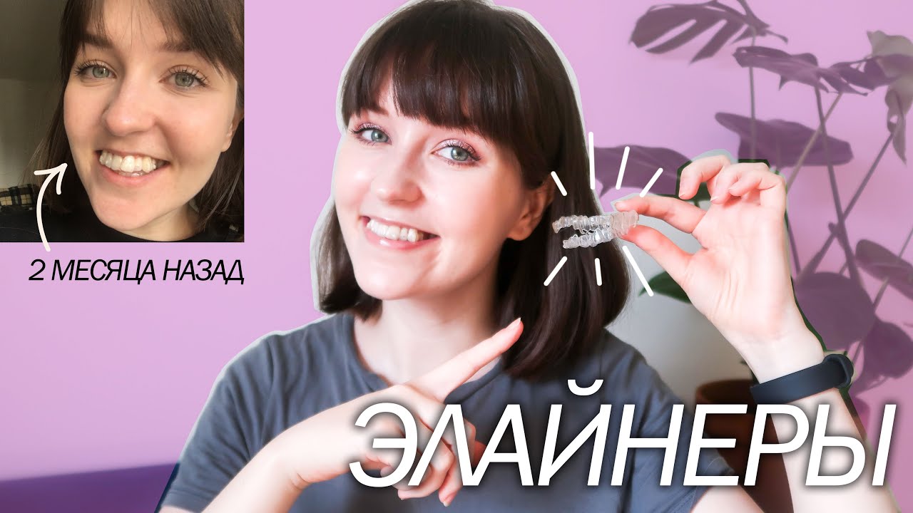 ЭЛАЙНЕРЫ | ВСЕ ЧТО НУЖНО ЗНАТЬ!