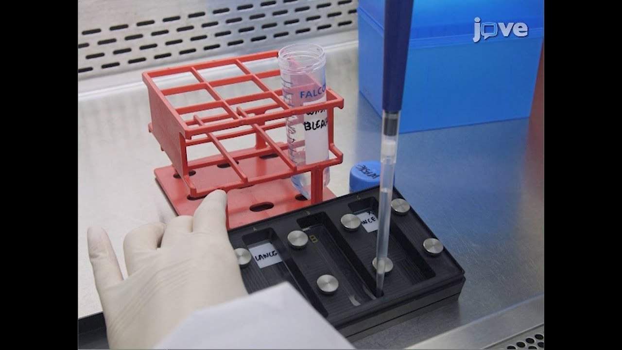 Peptide microarray immunoassay for diagnostic epitope discovery