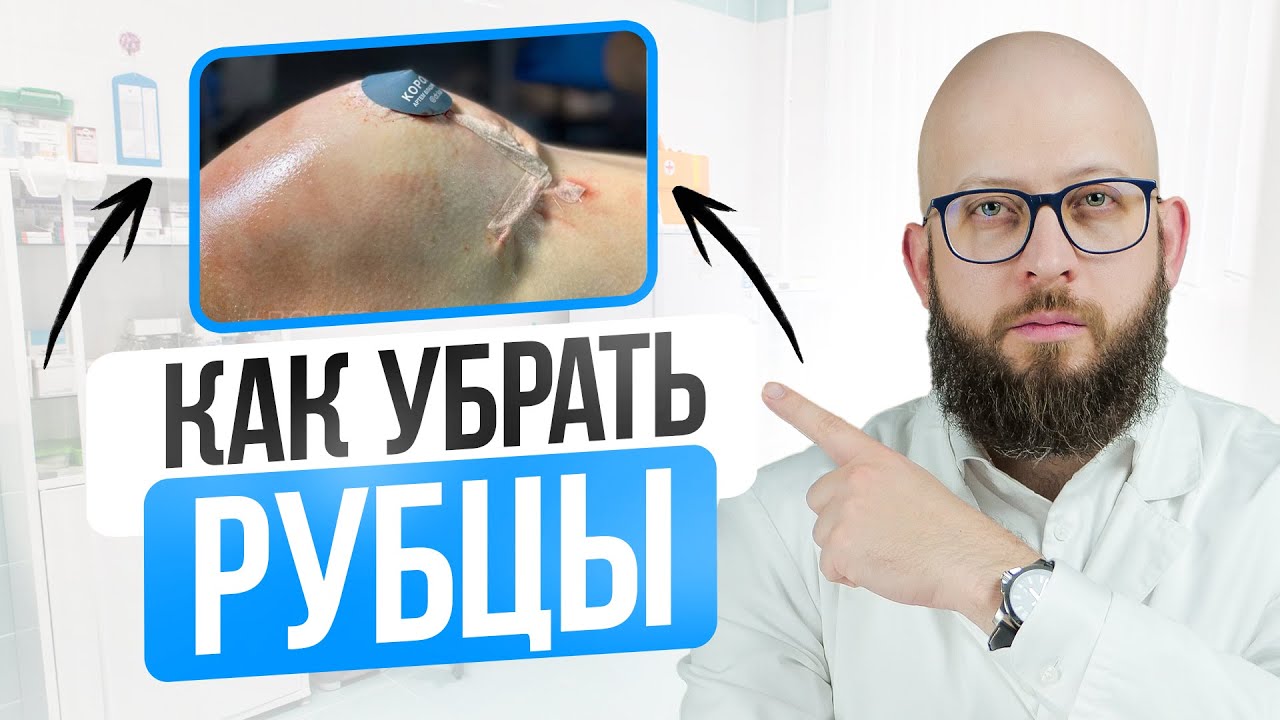 КАК УБРАТЬ РУБЦЫ ПОСЛЕ ОПЕРАЦИИ? Действенные способы. Уход за рубцами после операции