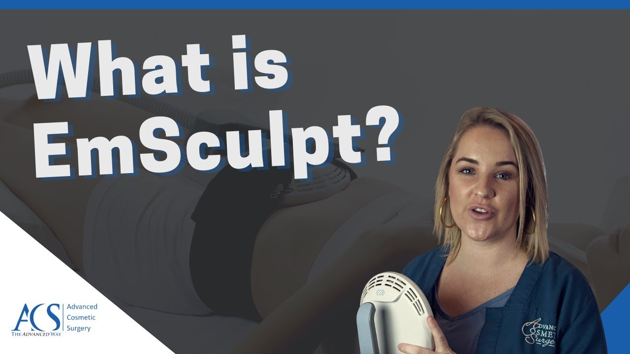 What is Emsculpt? How it Works and What You Should Expect