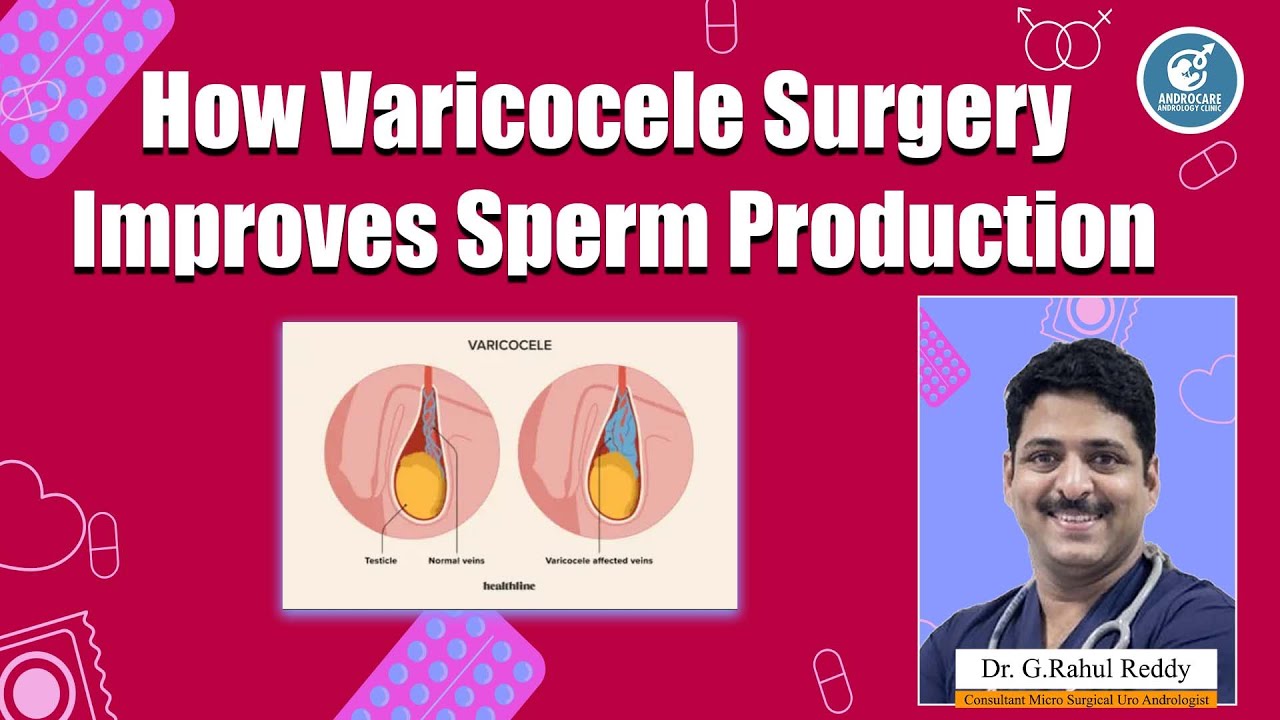How Varicocele Surgery Improves Sperm Production || Dr Rahul Reddy || Androcare Andrology Institute