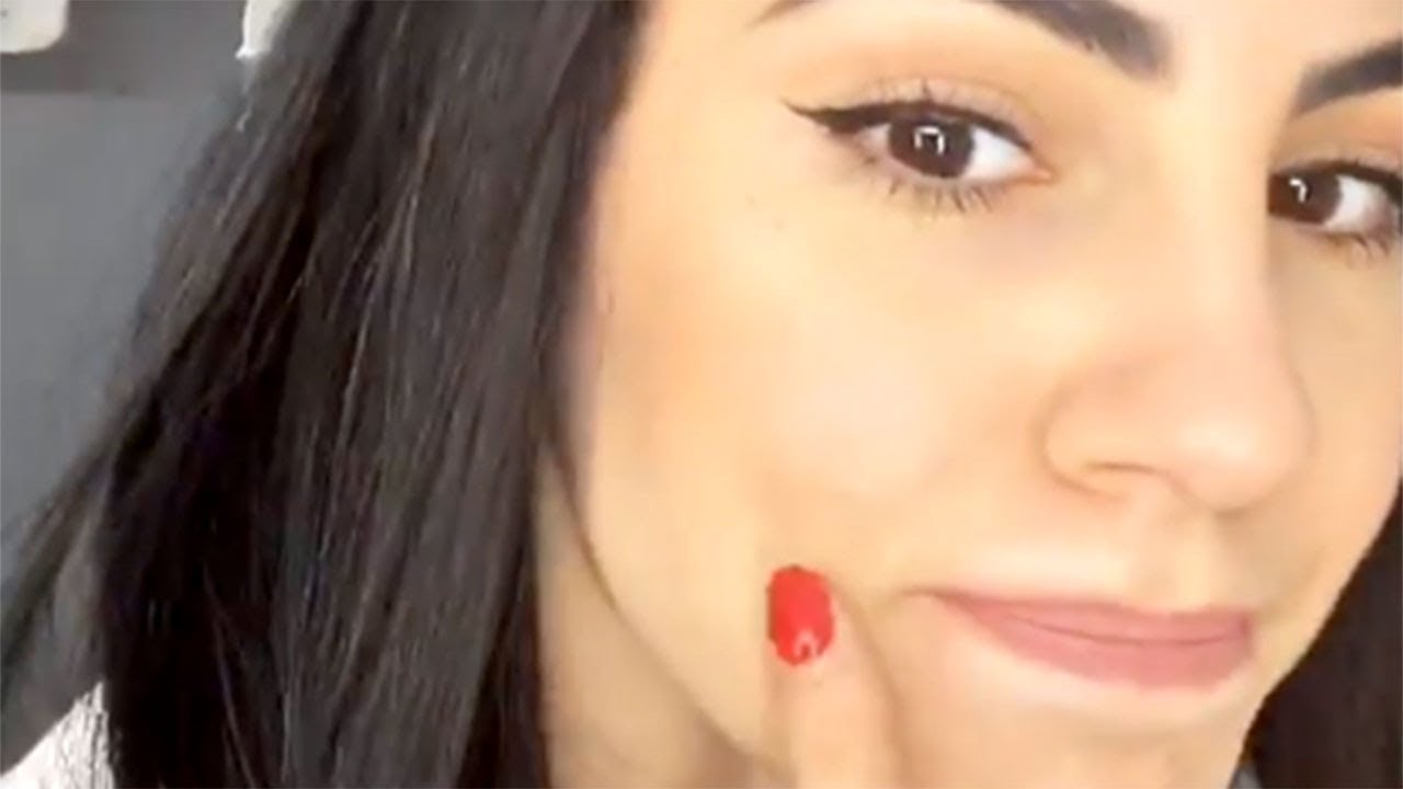 Giulia De Lellis spiega come curare l'acne