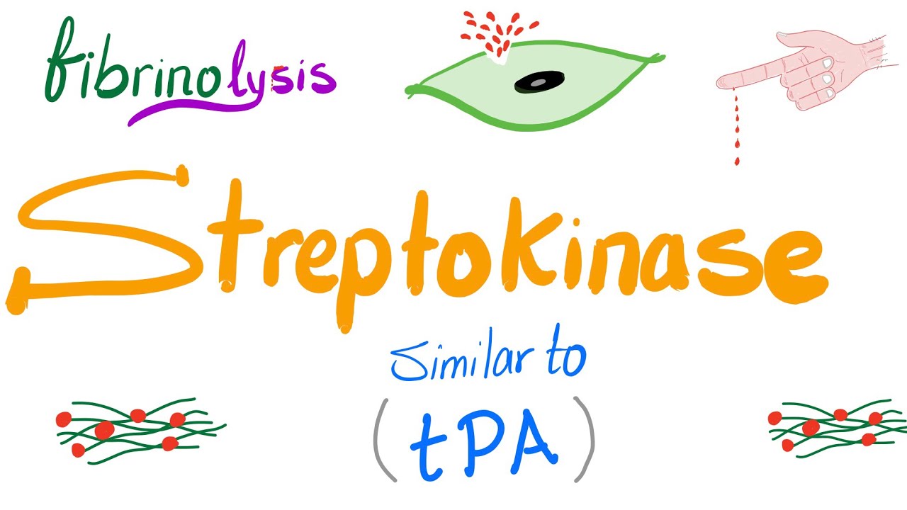 Fibrinolytic Therapy; Let&rsquo;s Destroy the Clot