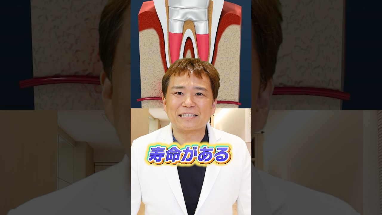 【これ本当】10年前に根管治療した歯は特に要注意
