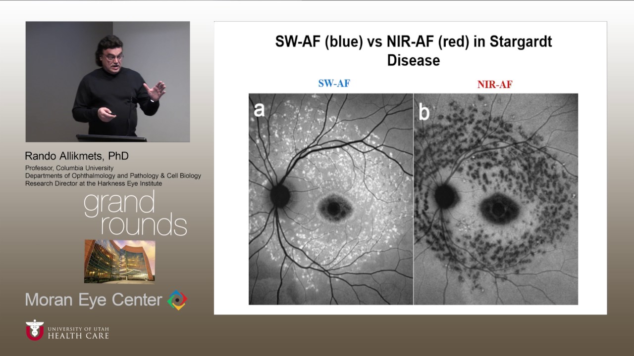 Clinical Spectrum of Stargardt and other ABCA4 Diseases