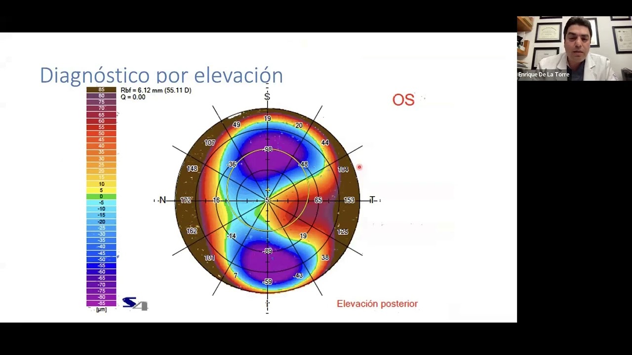 Usos y Aplicaciones del Topógrafo Sirius