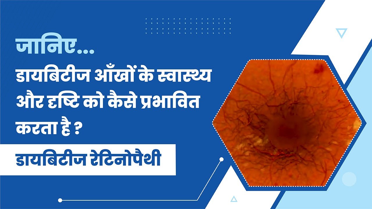 Diabetes Eye Care Special || #NdtvIndia - Netra Rakshak Episode-II