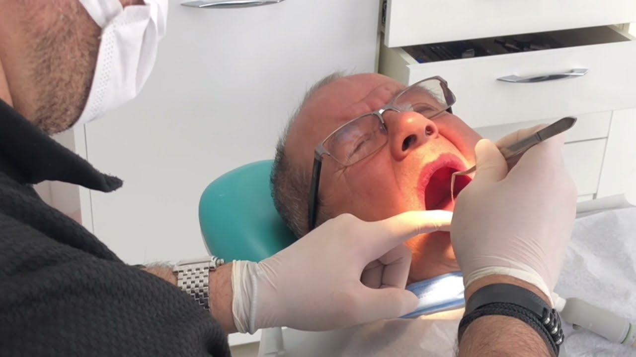 Endodonti-Kanal Tedavisi
