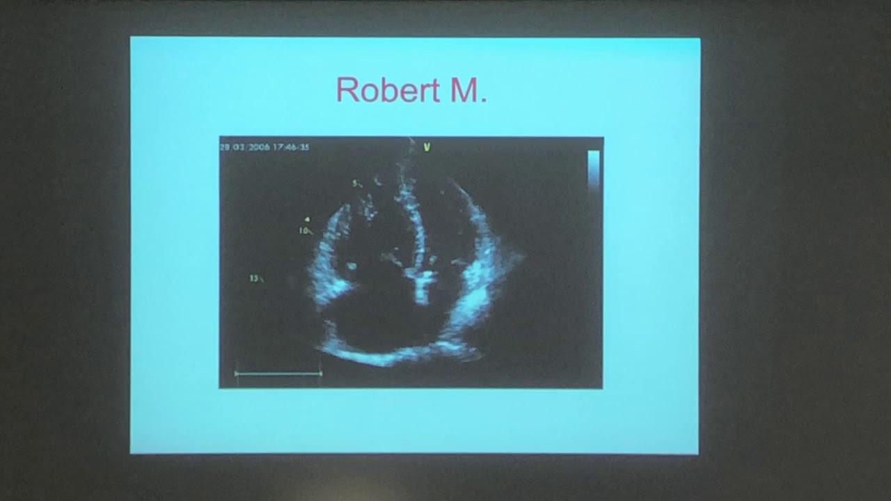 L’ECG nel paziente con dolore toracico acuto - Enrico Giuseppe Ruggiero
