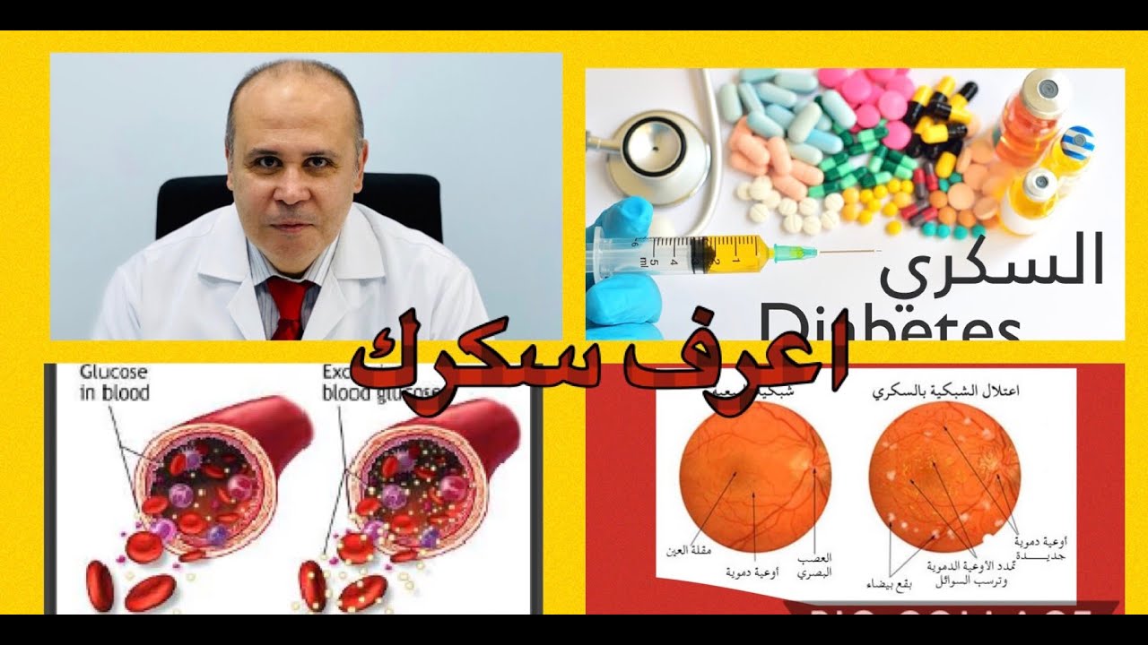 اسهل طريقه لعلاج مرض السكر بدون ادويه/علاج التراكمي من ١٤الي ٦ في  ٩٠ يوم بدون ادويه