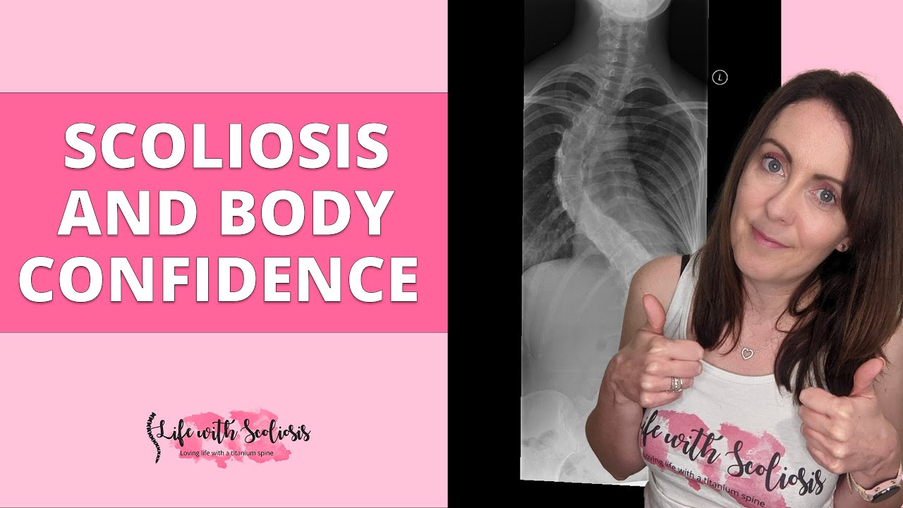 Scoliosis and Body Confidence | Life with Scoliosis