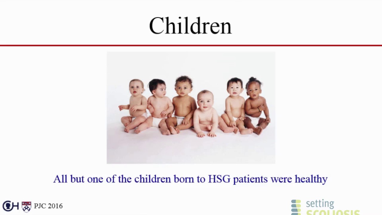 Pregnancy and Childbirth after Spinal Fusion for Adolescent Idiopathic Scoliosis