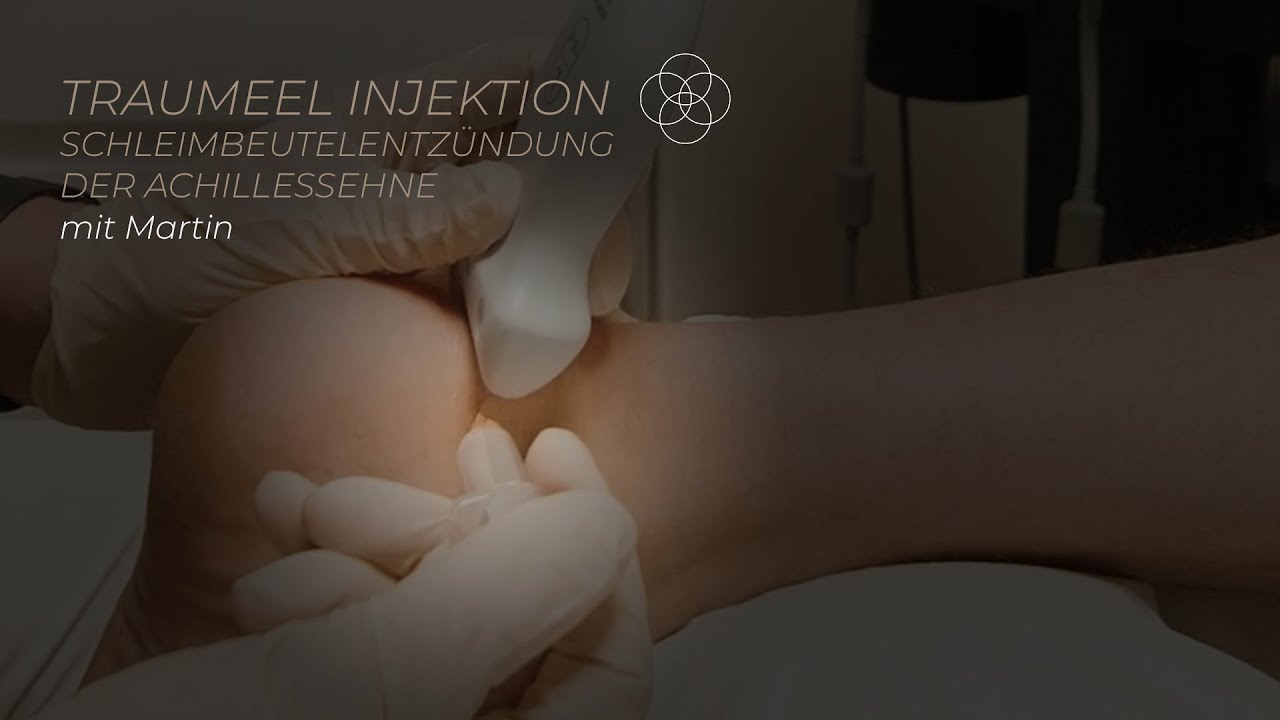 #Traumeel Injektion f&uuml;r #Schleimbeutelentz&uuml;ndung der #Achillessehne mit Dr. Martin Bartsch