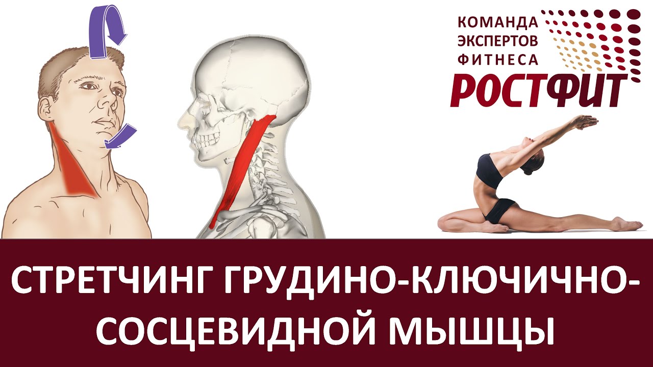 Стретчинг грудино-ключично-сосцевидной мышцы