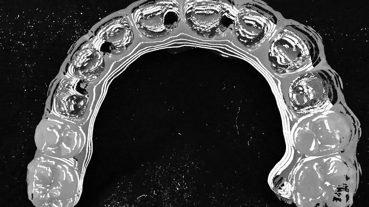 Micro Ucla Metálica Signo Vinces
