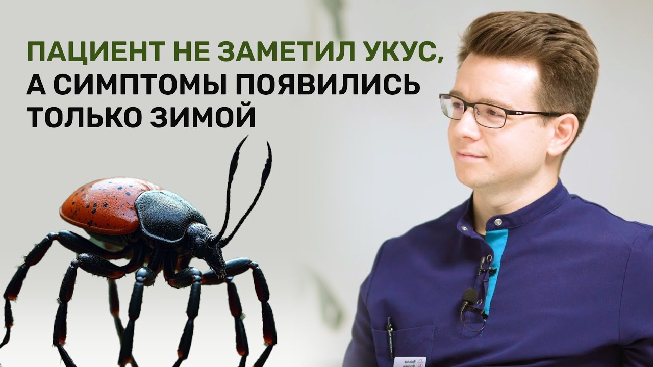 Болезнь Лайма: Что скрывается за укусом клеща?