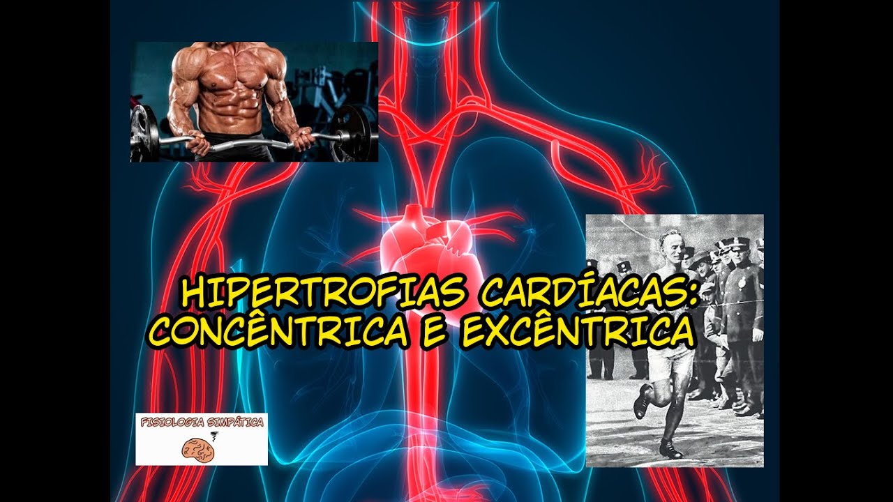 DIFERENÇAS ENTRE AS HIPERTROFIAS CARDÍACAS: CONCÊNTRICA E EXCÊNTRICA