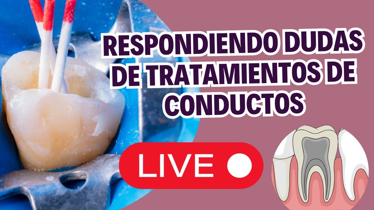Dudas del tratamiento de conductos y otras consultas 🦷✅
