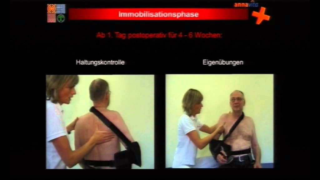 Nachbehandlung von Rotatorenmanschettenrekonstruktionen