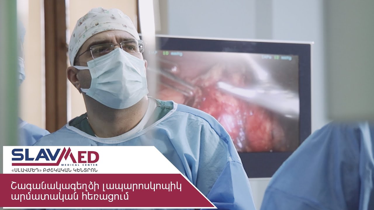 Շագանակագեղձի լապարոսկոպիկ արմատական հեռացում